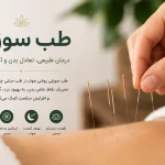 تصویر انجام طب سوزنی برای کاهش درد، درمان میگرن، کاهش استرس و بهبود سلامت در کلینیک انرژی حیات