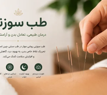 تصویر انجام طب سوزنی برای کاهش درد، درمان میگرن، کاهش استرس و بهبود سلامت در کلینیک انرژی حیات