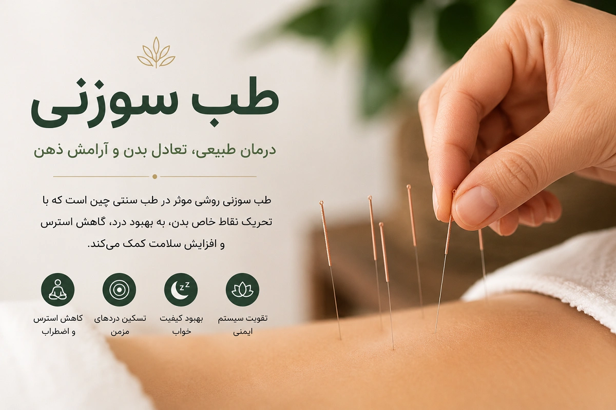 تصویر انجام طب سوزنی برای کاهش درد، درمان میگرن، کاهش استرس و بهبود سلامت در کلینیک انرژی حیات